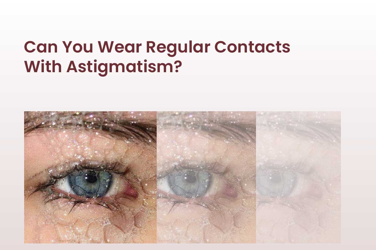 Can You Wear Regular Contacts With Astigmatism?